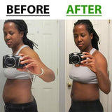 Glamorous Belly Slimming Patches - 1 SET (10 PATCHES)