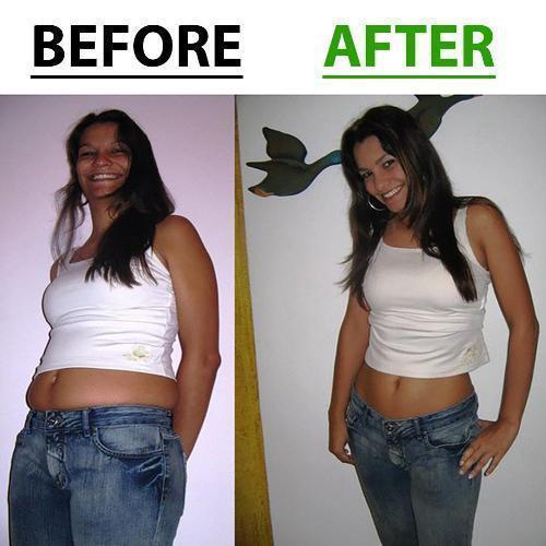 Glamorous Belly Slimming Patches - 1 SET (10 PATCHES)