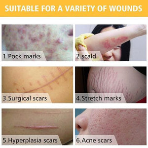 Acne Scar Remover Cream