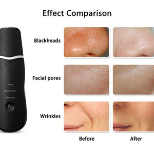 Ultrasonic Facial Cleansing Brush