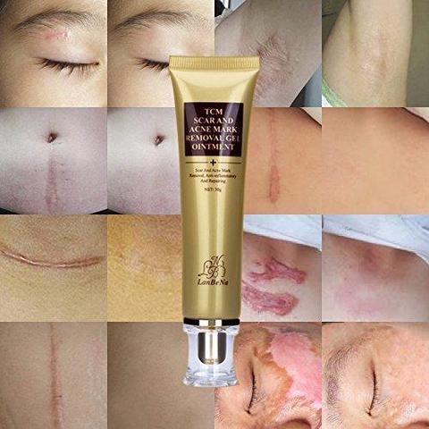 Acne Scar Remover Cream