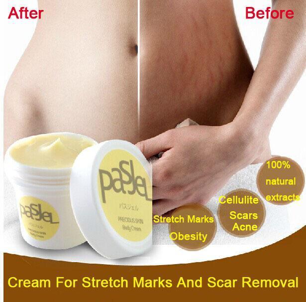 Anti Stretch Mark Cream