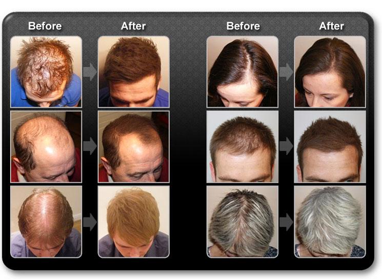 HAIR BUILDING FIBERS