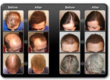 HAIR BUILDING FIBERS