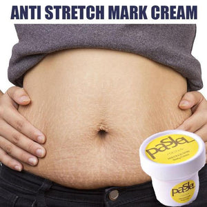 Anti Stretch Mark Cream