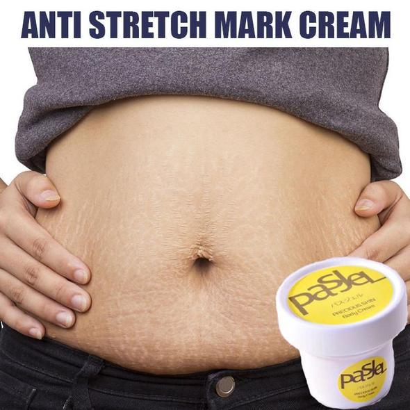 Anti Stretch Mark Cream