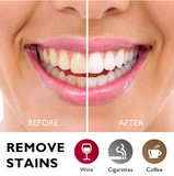 Black Pearl Teeth Whitener