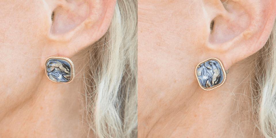 18K Gold Hypoallergenic Support Earring Backs