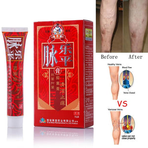 Varicose Veins Treatment Cream